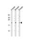 Fibroblast Growth Factor 12 antibody, PA5-49517, Invitrogen Antibodies, Western Blot image 