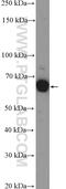 SHC Adaptor Protein 1 antibody, 10054-1-AP, Proteintech Group, Western Blot image 