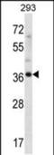 Ankyrin Repeat Domain 60 antibody, PA5-48534, Invitrogen Antibodies, Western Blot image 