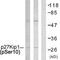 Cyclin Dependent Kinase Inhibitor 1B antibody, LS-C117438, Lifespan Biosciences, Western Blot image 