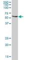 Thioredoxin Reductase 1 antibody, H00007296-B01P, Novus Biologicals, Western Blot image 