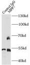 Membrane Palmitoylated Protein 7 antibody, FNab05291, FineTest, Immunoprecipitation image 