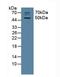 Acetylcholine Receptor antibody, LS-C299137, Lifespan Biosciences, Western Blot image 