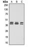 Erk1 antibody, LS-C368618, Lifespan Biosciences, Western Blot image 