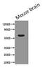 Podocalyxin Like antibody, CSB-MA134471A0m, Cusabio, Western Blot image 