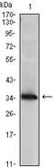 NME/NM23 Nucleoside Diphosphate Kinase 1 antibody, MA5-15642, Invitrogen Antibodies, Western Blot image 