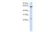 Transmembrane Protein 138 antibody, A13052, Boster Biological Technology, Western Blot image 