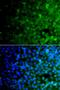 Interleukin 21 Receptor antibody, orb247999, Biorbyt, Immunofluorescence image 