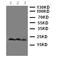 Thy-1 Cell Surface Antigen antibody, LS-C312680, Lifespan Biosciences, Western Blot image 