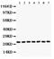 Glutathione S-Transferase Pi 1 antibody, PB9184, Boster Biological Technology, Western Blot image 