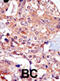 Transient Receptor Potential Cation Channel Subfamily M Member 7 antibody, abx025138, Abbexa, Immunohistochemistry paraffin image 