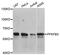 6-Phosphofructo-2-Kinase/Fructose-2,6-Biphosphatase 3 antibody, STJ111245, St John