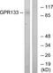 Adhesion G Protein-Coupled Receptor D1 antibody, A30805, Boster Biological Technology, Western Blot image 