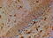 Transient Receptor Potential Cation Channel Subfamily M Member 7 antibody, 46-531, ProSci, Immunohistochemistry paraffin image 