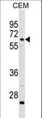 Complement C8 Beta Chain antibody, LS-C157599, Lifespan Biosciences, Western Blot image 