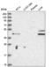 Rh Family B Glycoprotein (Gene/Pseudogene) antibody, NBP2-59022, Novus Biologicals, Western Blot image 