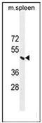 ERCC Excision Repair 8, CSA Ubiquitin Ligase Complex Subunit antibody, AP51450PU-N, Origene, Western Blot image 