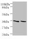 SNX20 antibody, A53539-100, Epigentek, Western Blot image 