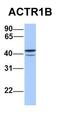 C1D Nuclear Receptor Corepressor antibody, orb330618, Biorbyt, Western Blot image 