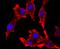 Tyrosinase antibody, NBP2-67233, Novus Biologicals, Immunocytochemistry image 