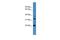 Archaelysin Family Metallopeptidase 2 antibody, GTX48918, GeneTex, Western Blot image 