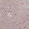 Actin Related Protein 5 antibody, NBP2-14524, Novus Biologicals, Immunohistochemistry paraffin image 