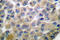 Matrix Metallopeptidase 8 antibody, LS-C176131, Lifespan Biosciences, Immunohistochemistry paraffin image 