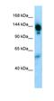 Alpha-2-Macroglobulin antibody, orb326285, Biorbyt, Western Blot image 