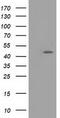 Taspase 1 antibody, TA502257S, Origene, Western Blot image 