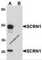 Secernin 1 antibody, 5849, ProSci Inc, Western Blot image 