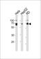 Protein Kinase AMP-Activated Non-Catalytic Subunit Gamma 3 antibody, PA5-35182, Invitrogen Antibodies, Western Blot image 