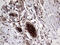 Anterior Gradient 2, Protein Disulphide Isomerase Family Member antibody, LS-C799865, Lifespan Biosciences, Immunohistochemistry paraffin image 