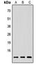 Neuregulin 4 antibody, abx121652, Abbexa, Western Blot image 