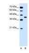 Solute Carrier Family 35 Member B1 antibody, NBP1-62266, Novus Biologicals, Western Blot image 