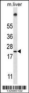 Ubiquitin Conjugating Enzyme E2 W antibody, 57-153, ProSci, Western Blot image 