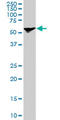 Stress Induced Phosphoprotein 1 antibody, LS-B6208, Lifespan Biosciences, Western Blot image 