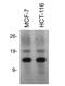 Histone Cluster 1 H2A Family Member E antibody, NB100-56346, Novus Biologicals, Western Blot image 