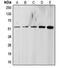 Transforming Growth Factor Beta Receptor 1 antibody, MBS820469, MyBioSource, Western Blot image 