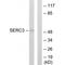 Serine Incorporator 3 antibody, PA5-49823, Invitrogen Antibodies, Western Blot image 