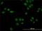 Nuclear Receptor Subfamily 1 Group D Member 1 antibody, H00009572-M02, Novus Biologicals, Immunocytochemistry image 