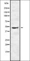 Complement C5 antibody, orb336778, Biorbyt, Western Blot image 
