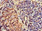 CCAAT Enhancer Binding Protein Alpha antibody, orb48049, Biorbyt, Immunohistochemistry paraffin image 