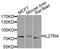 Interleukin 27 Receptor Subunit Alpha antibody, STJ110475, St John