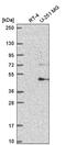 F-Box And WD Repeat Domain Containing 11 antibody, NBP2-56451, Novus Biologicals, Western Blot image 