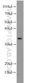Parvin Alpha antibody, 55268-1-AP, Proteintech Group, Western Blot image 