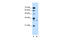 Syndecan Binding Protein antibody, ARP44535_T100, Aviva Systems Biology, Western Blot image 
