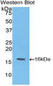 Troponin T3, Fast Skeletal Type antibody, LS-C297117, Lifespan Biosciences, Western Blot image 