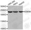 Lysine Demethylase 3B antibody, A2312, ABclonal Technology, Western Blot image 
