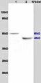 Potassium Calcium-Activated Channel Subfamily N Member 4 antibody, orb101130, Biorbyt, Western Blot image 