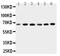 Cholesteryl Ester Transfer Protein antibody, PA2019, Boster Biological Technology, Western Blot image 